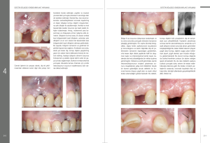İmplant Çevresi Estetik Mukogingival Cerrahi
