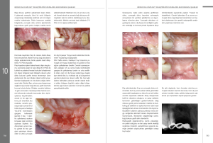 İmplant Çevresi Estetik Mukogingival Cerrahi