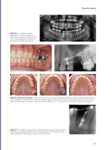 İLERİ ORAL CERRAHİ