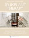 4D Implant Therapy