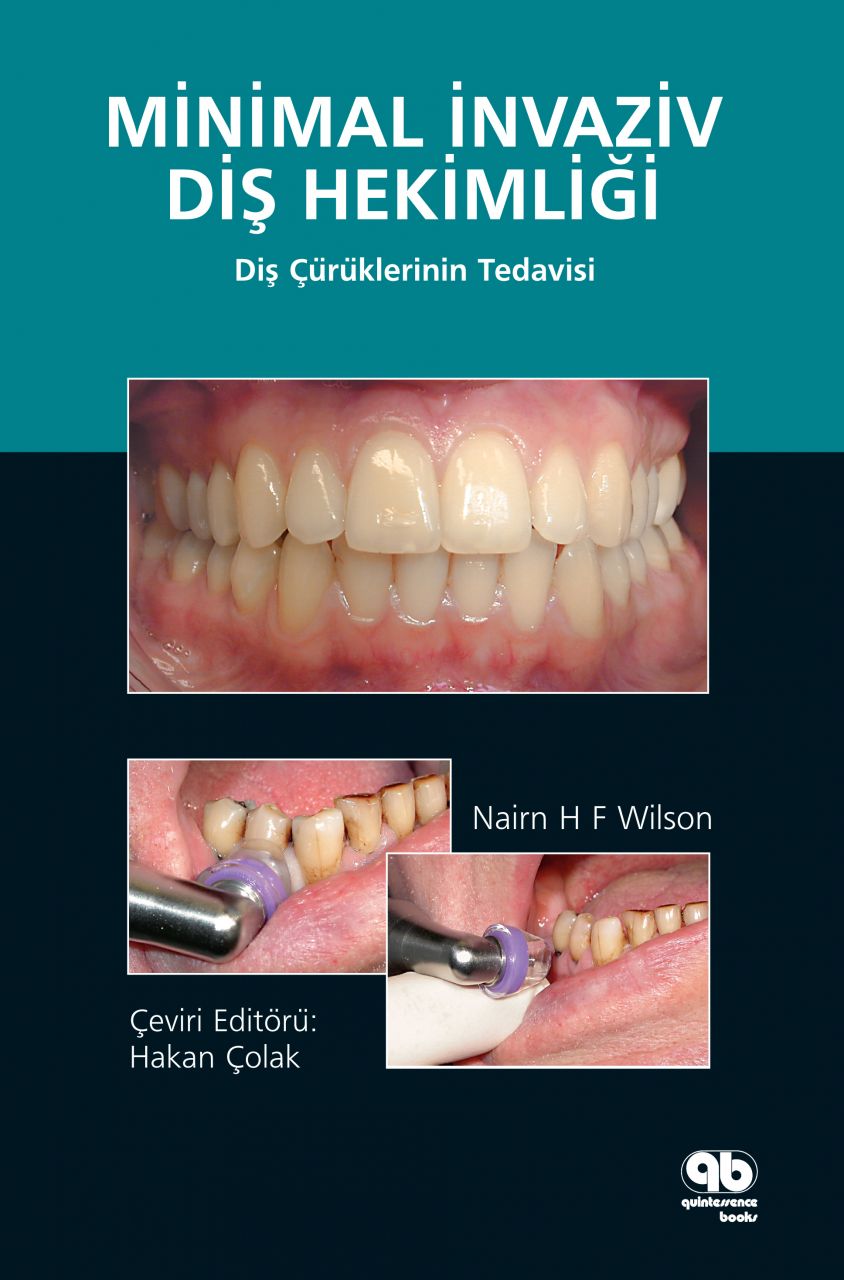 Minimal İnvaziv Diş Hekimliği - Diş Çürüklerinin Tedavisi