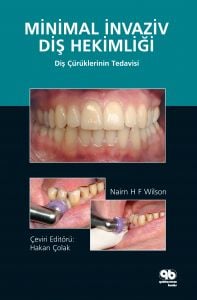 Minimal İnvaziv Diş Hekimliği - Diş Çürüklerinin Tedavisi