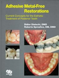 Adhesive metal-free restorations