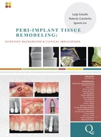 Peri-Implant Tissue Remodeling