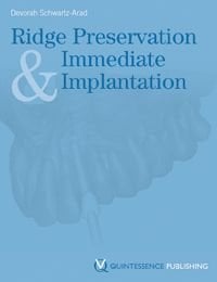 Ridge Preservation and Immediate Implantation