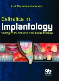 Esthetics in Implantology Strategies for Soft and Hard Tissue Therapy