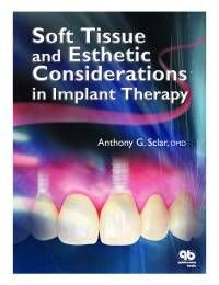 Soft Tissue and Esthetic Considerations in Implant Therapy