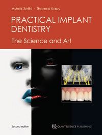 Practical Implant Dentistry The Science and Art