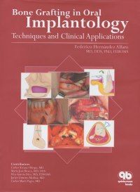 Bone Grafting in Oral Implantology: Techniques and Clinical Applications