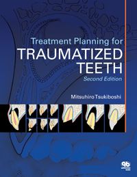 Treatment Planning for Traumatized Teeth