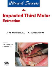 Clinical Success in Impacted Third Molar Extraction