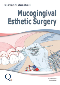 Mucogingival Esthetic Surgery