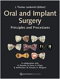 Oral and Implant Surgery: Principles and Procedures