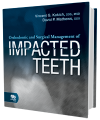Orthodontic and Surgical Management of Impacted Teeth