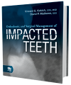 Orthodontic and Surgical Management of Impacted Teeth