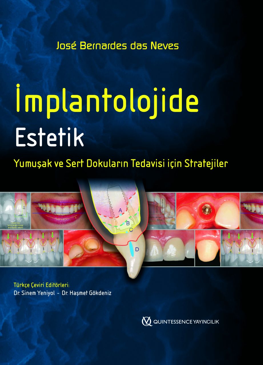İmplantolojide Estetik - Yumuşak ve Sert Dokuların Tedavisi için Stratejiler