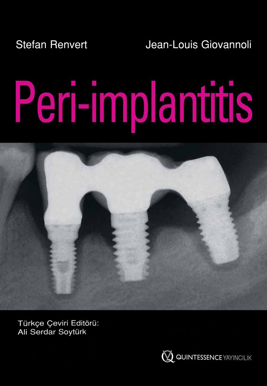 Peri-implantitis