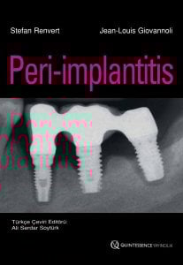 Peri-implantitis