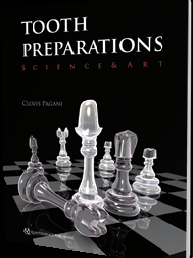 Tooth Preparations