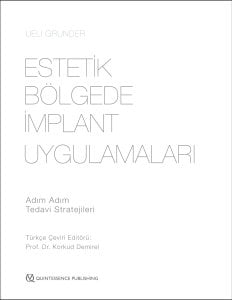 Estetik bölgede implant uygulamaları-Adım adım tedavi stratejileri