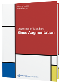 Essentials of Maxillary Sinus Augmentation