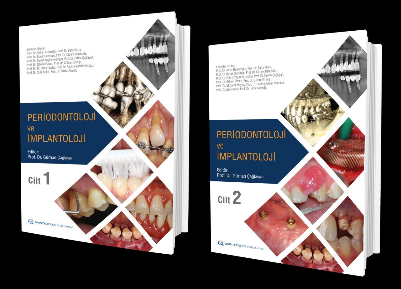 Periodontoloji ve İmplantoloji (Cilt 1 ve 2) Prof. Dr. Gürhan Çağlayan