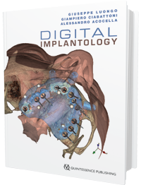 Digital Implantology