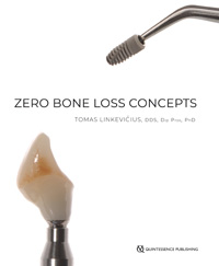 Zero Bone Loss Concepts
