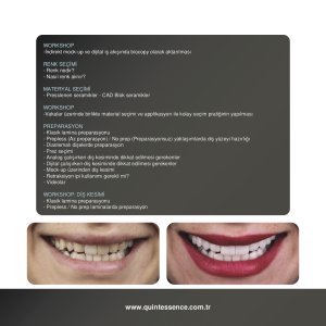 Porselen Lamina Venerler - Dijital ve Analog İş Akışı