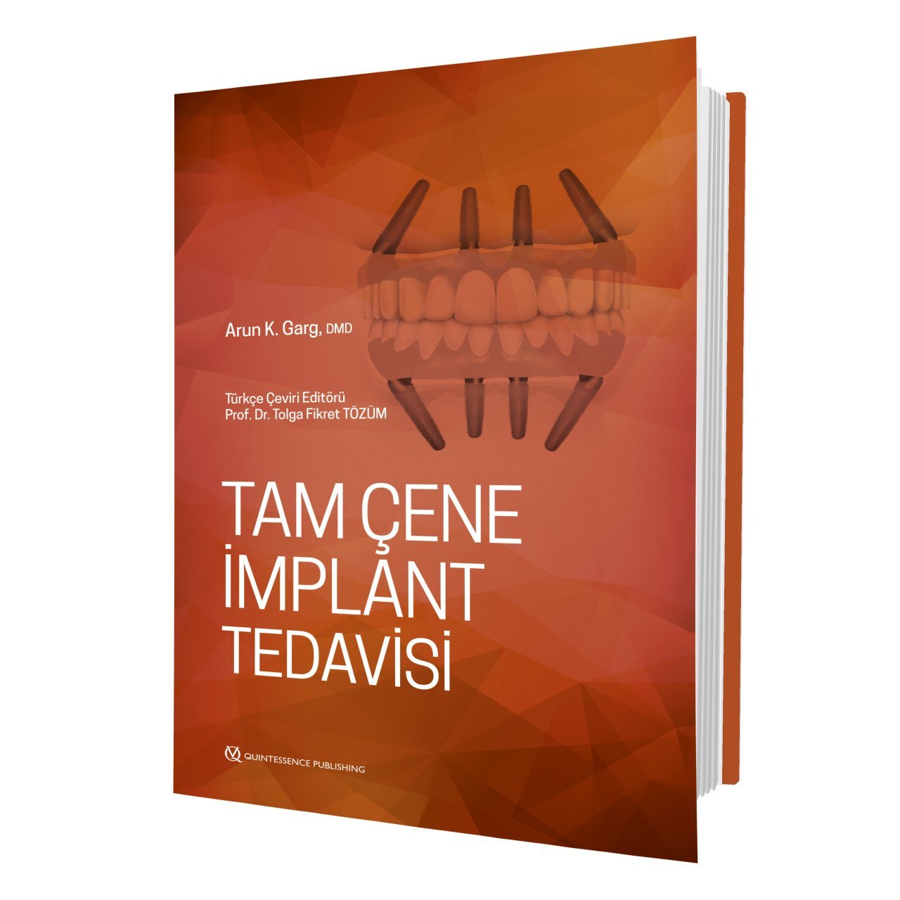 Diş Hekimleri İçin TAM ÇENE İMPLANT TEDAVİSİ Klinik Rehberi - VI