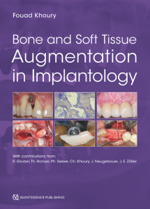 Bone and Soft Tissue Augmentation in Implantology