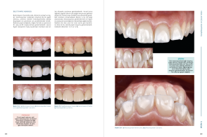 Anterior Estetikte Kompozit Restorasyonlar / Doç. Dr. Bora Korkut - GÜNCELLENMİŞ 3. BASKI