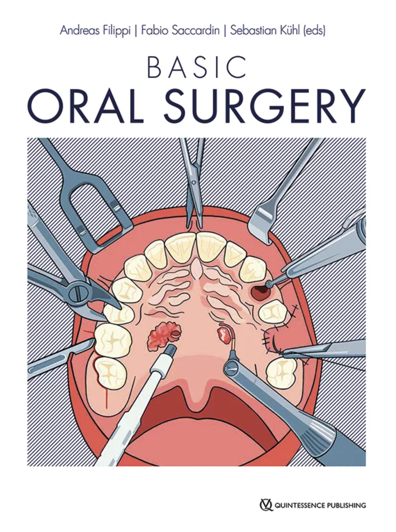 Basic Oral Surgery