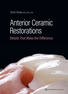 Anterior Ceramic Restorations