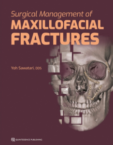 Surgical Management of Maxillofacial Fractures