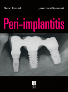 Peri-implantitis