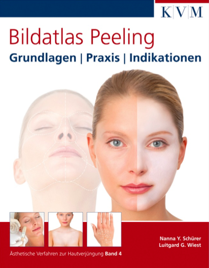 Bildatlas Peeling