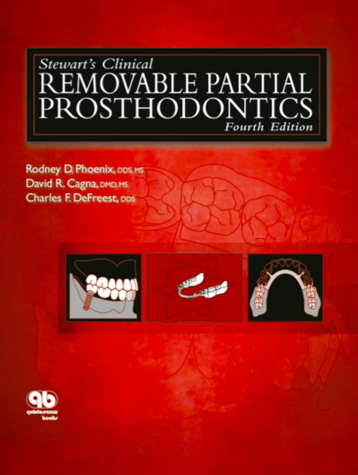 Stewart's Clinical Removable Partial Prosthodontics