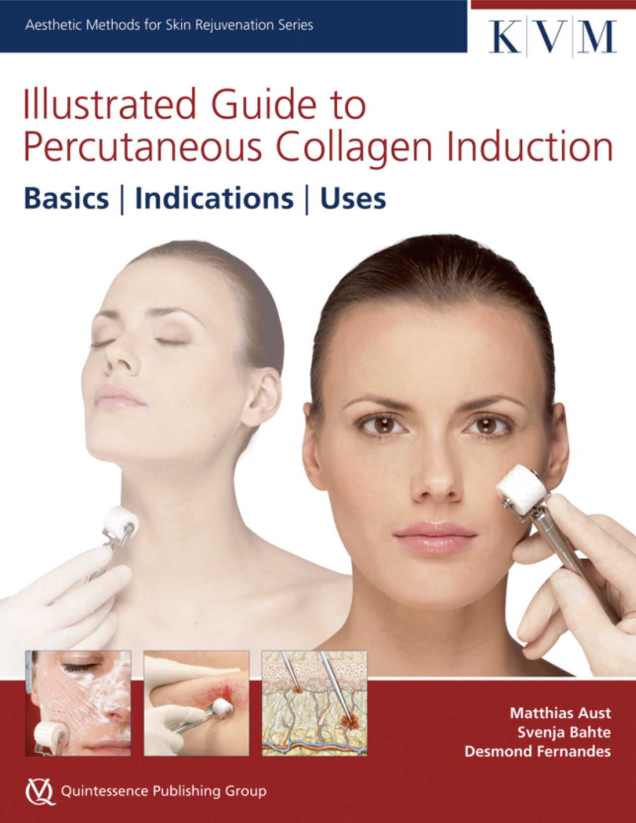 Illustrated Guide to Percutaneous Collagen Induction Basics | Indications | Uses