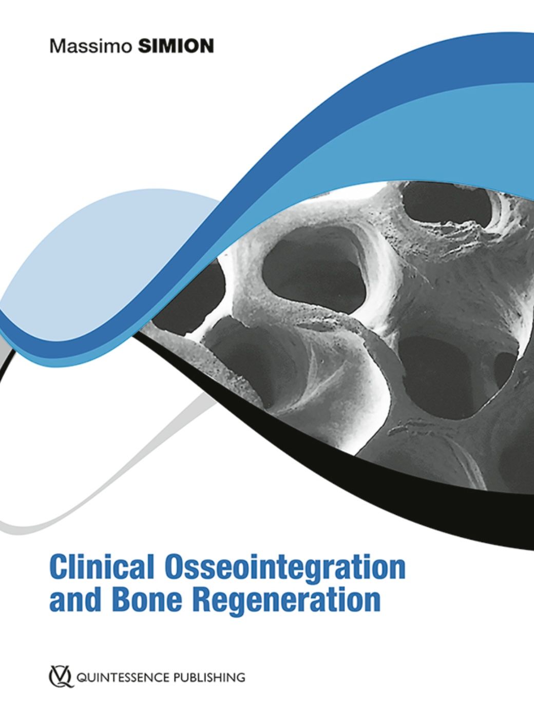 Clinical Osseointegration and Bone Regeneration