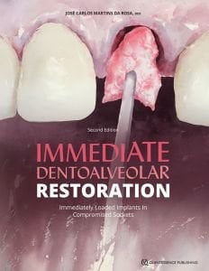 Immediate Dentoalveolar Restoration