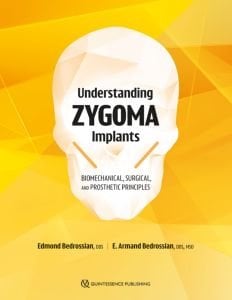 Understanding Zygoma Implants Biomechanical, Surgical, and Prosthetic Principles