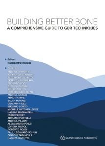 Building Better Bone A Comprehensive Guide to GBR techniques