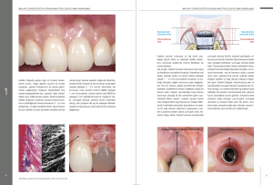 İmplant Çevresi Estetik Mukogingival Cerrahi (MAYIS AYI FIRSAT ÜRÜNÜ)