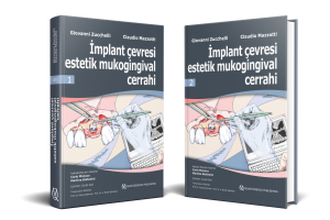 İmplant Çevresi Estetik Mukogingival Cerrahi (MAYIS AYI FIRSAT ÜRÜNÜ)