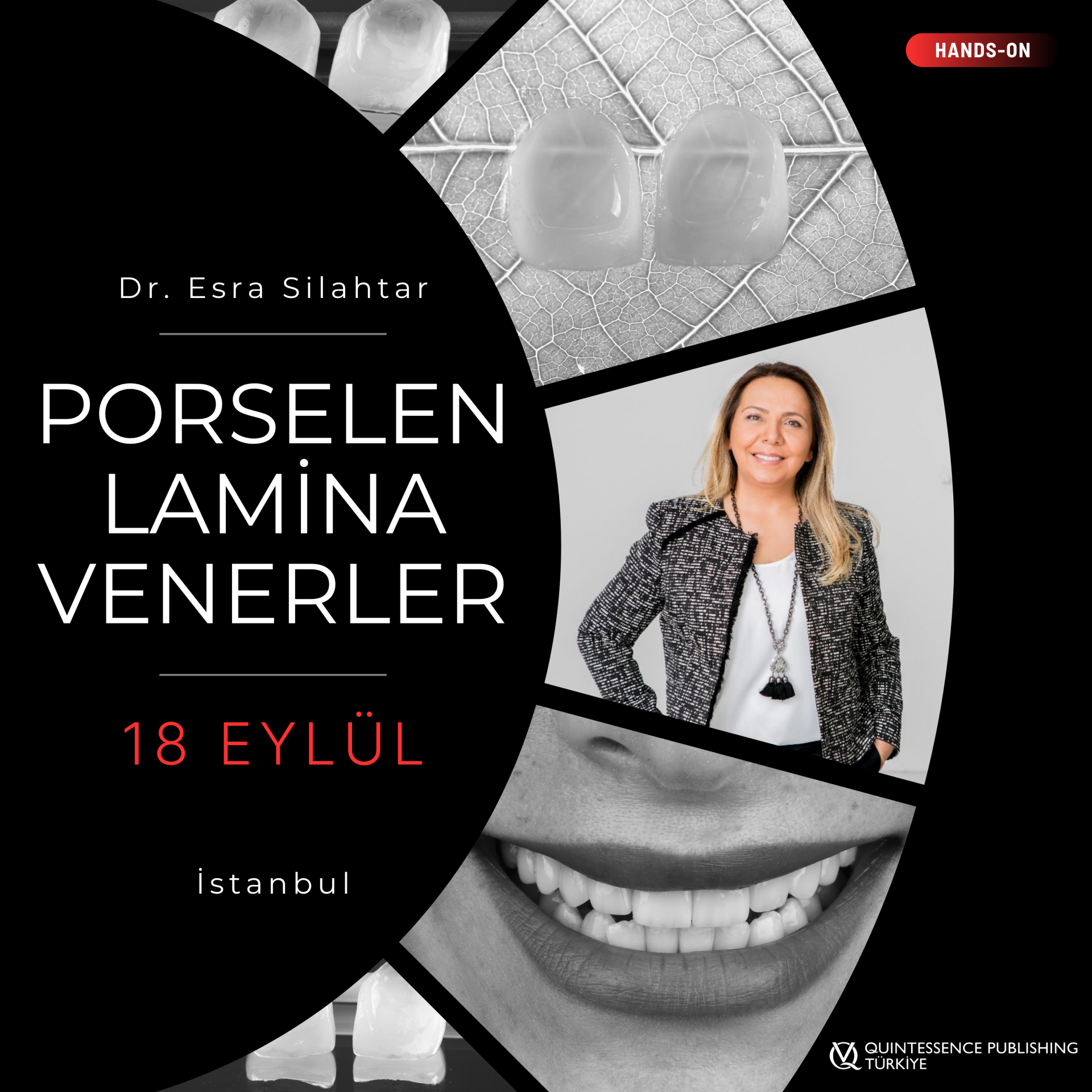 Porselen Lamina Venerler - 18 EYLÜL 2026