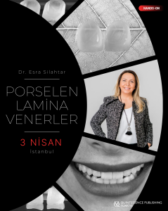 Porselen Lamina Venerler - 3 Nisan 2026