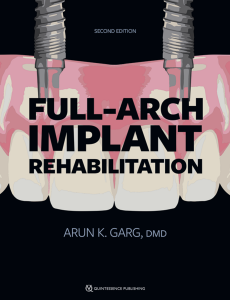 Full-Arch Implant Rehabilitation