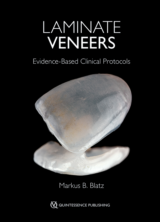 Markus B. Blatz Laminate Veneers Evidence-Based Clinical Protocols