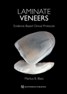 Markus B. Blatz Laminate Veneers Evidence-Based Clinical Protocols